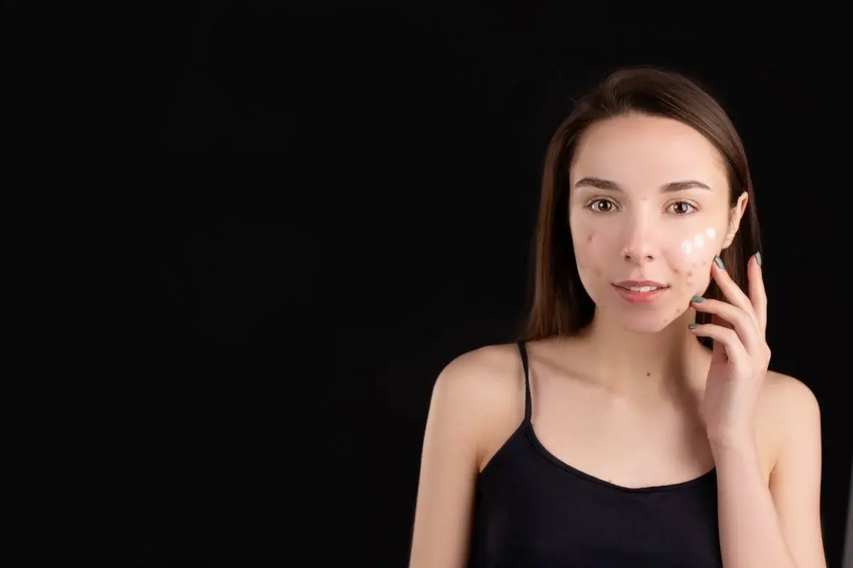 how to get rid of pimple scars naturally